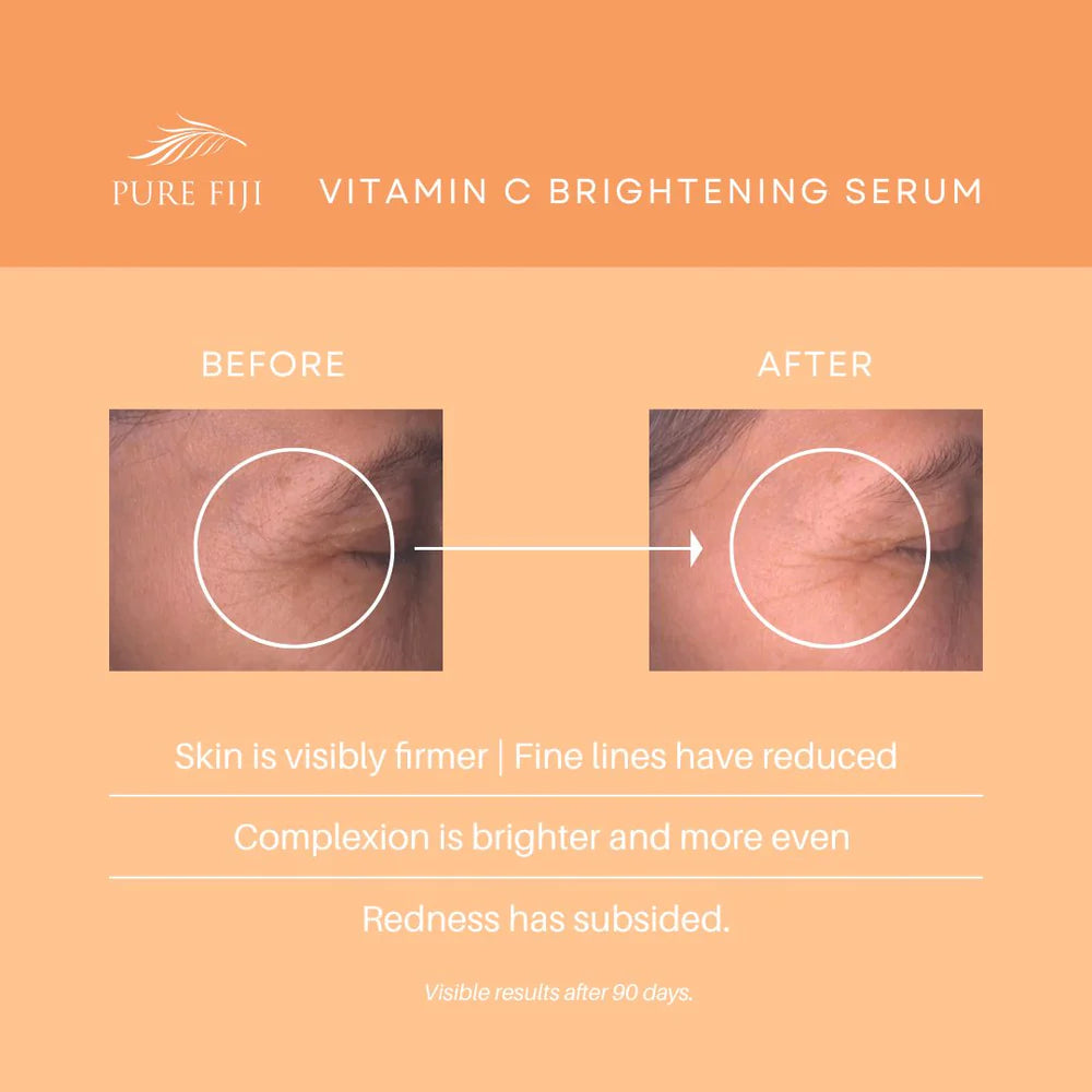 Pure Fiji Kakadu Super Vitamin C Brightening Serum With Hyaluronate + Bakuchiol